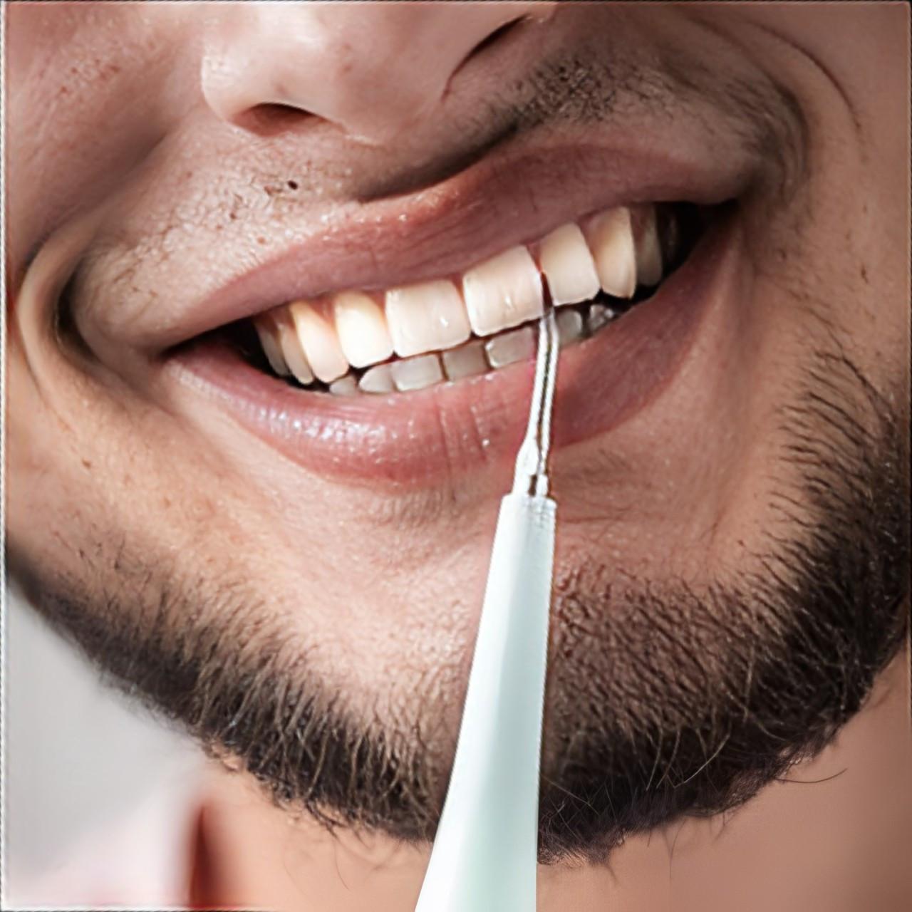 Skaler Dentystyczny Do Pielęgnacji Zębów – Wodoodporny, 5 Poziomów Intensywności 2