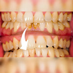 Skaler Dentystyczny Do Pielęgnacji Zębów – Wodoodporny, 5 Poziomów Intensywności 4