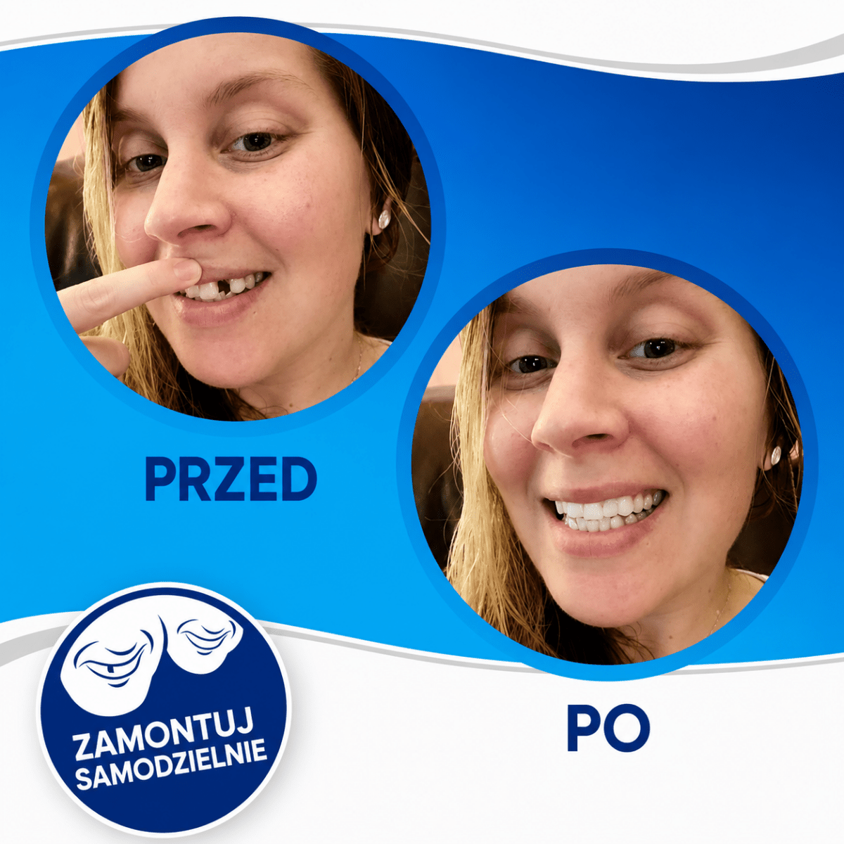 Fornir Uśmiechowy do Poprawy Uśmiechu - Trwałe Licówki, Medyczna Jakość, Idealne Dopasowanie  9