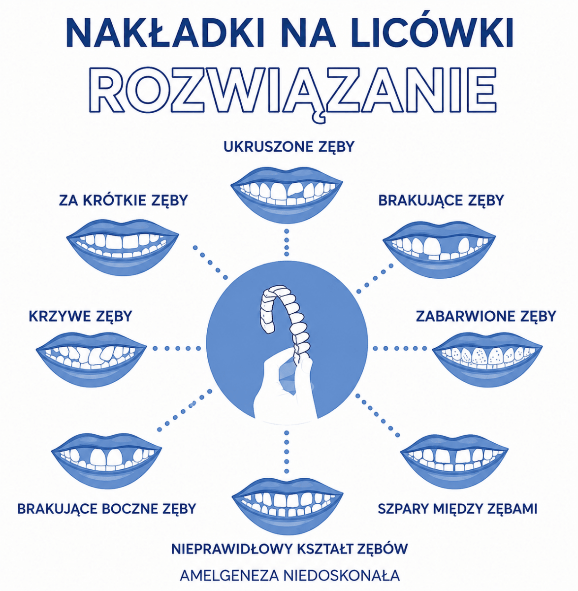 Fornir Uśmiechowy do Poprawy Uśmiechu - Trwałe Licówki, Medyczna Jakość, Idealne Dopasowanie  3