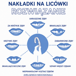 Fornir Uśmiechowy do Poprawy Uśmiechu - Trwałe Licówki, Medyczna Jakość, Idealne Dopasowanie  3
